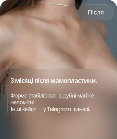 Після