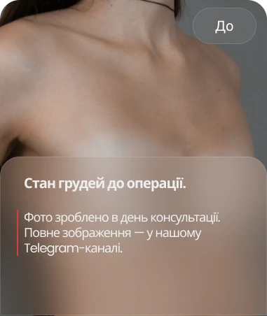 До
